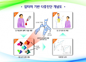 피 한방울로 조기 암(癌)진단시대 연다