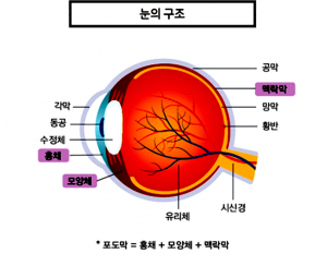 시력저하에 실명까지 유발하는 포도막염