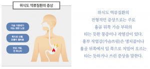 신년회 많은 새해, 위식도 역류질환 주의보